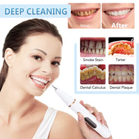 Thumbnail for Teeth Cleaner Smoke Stains Plaque