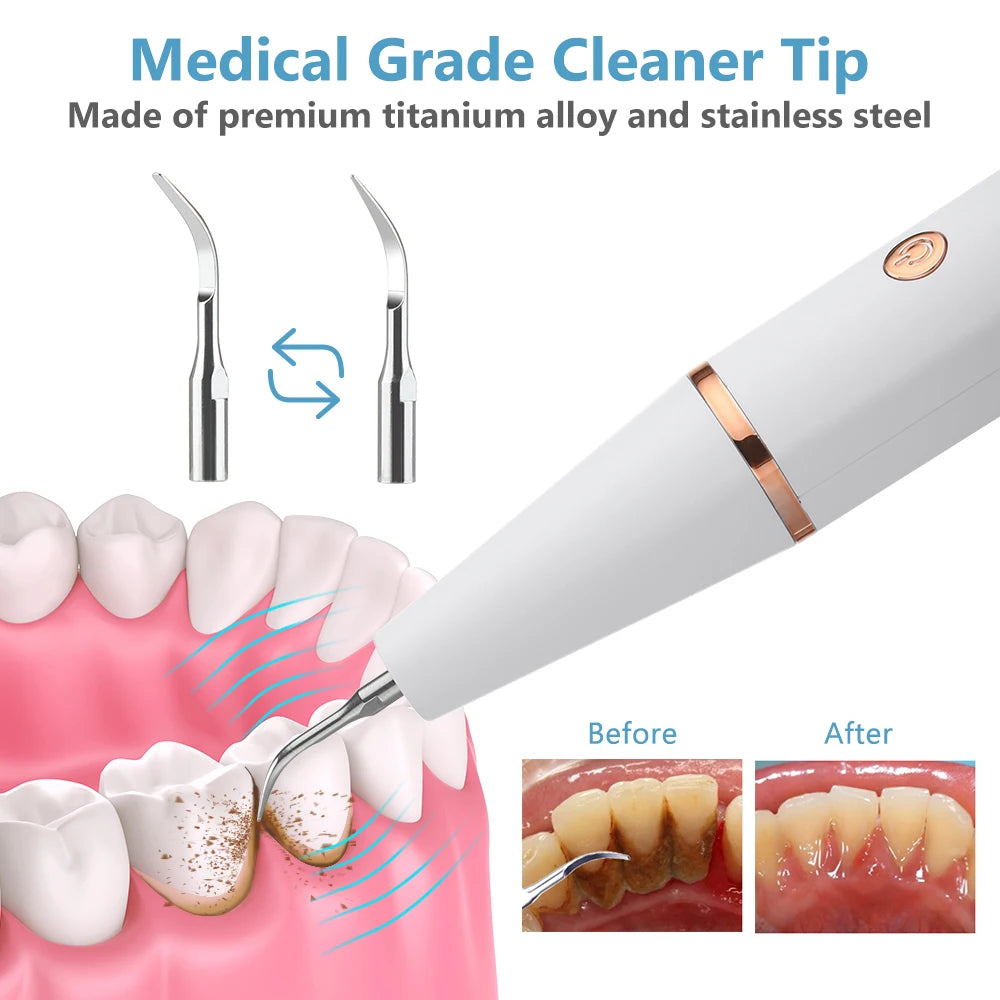 Teeth Cleaner Smoke Stains Plaque