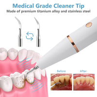 Thumbnail for Teeth Cleaner Smoke Stains Plaque